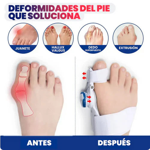 CORRECTOR DE JUANETE AJUSTABLE