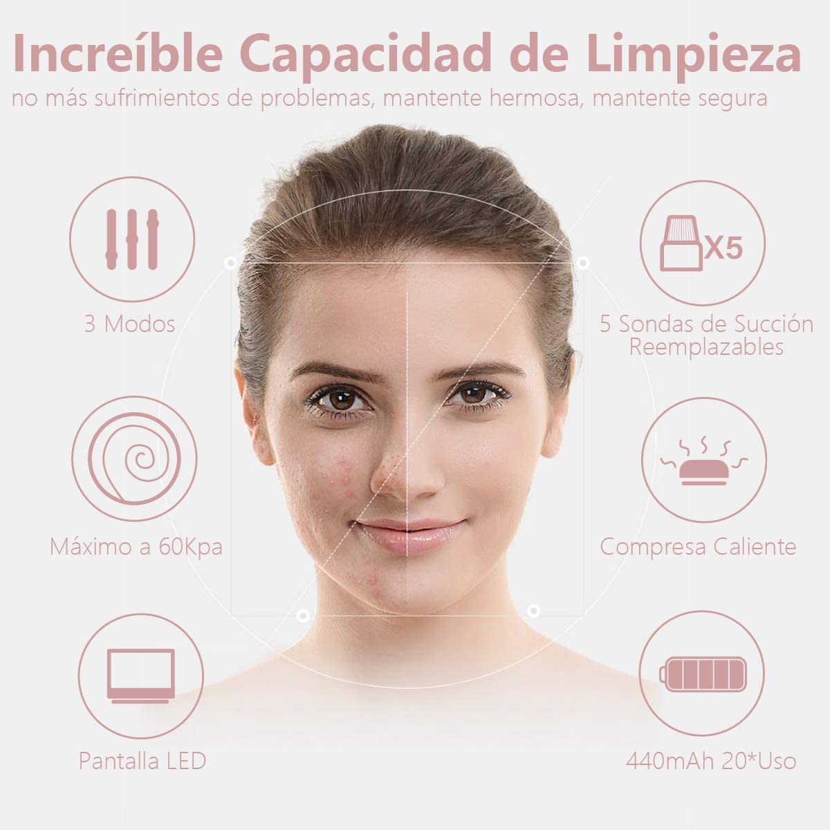 #proSuccionador de Puntos Negros | Limpiador Facial | Remover Puntos Negros | USB Recargable con Pantalla LEDduct_name# - TeknoTienda